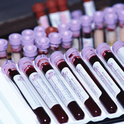 Blood samples