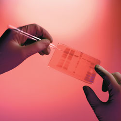 hemophilia treatment