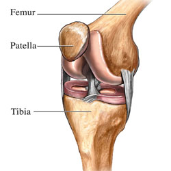 Knee replacement