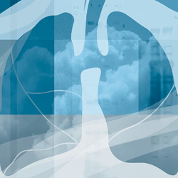Lung X-ray
