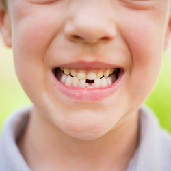 Boy grinning with missing tooth